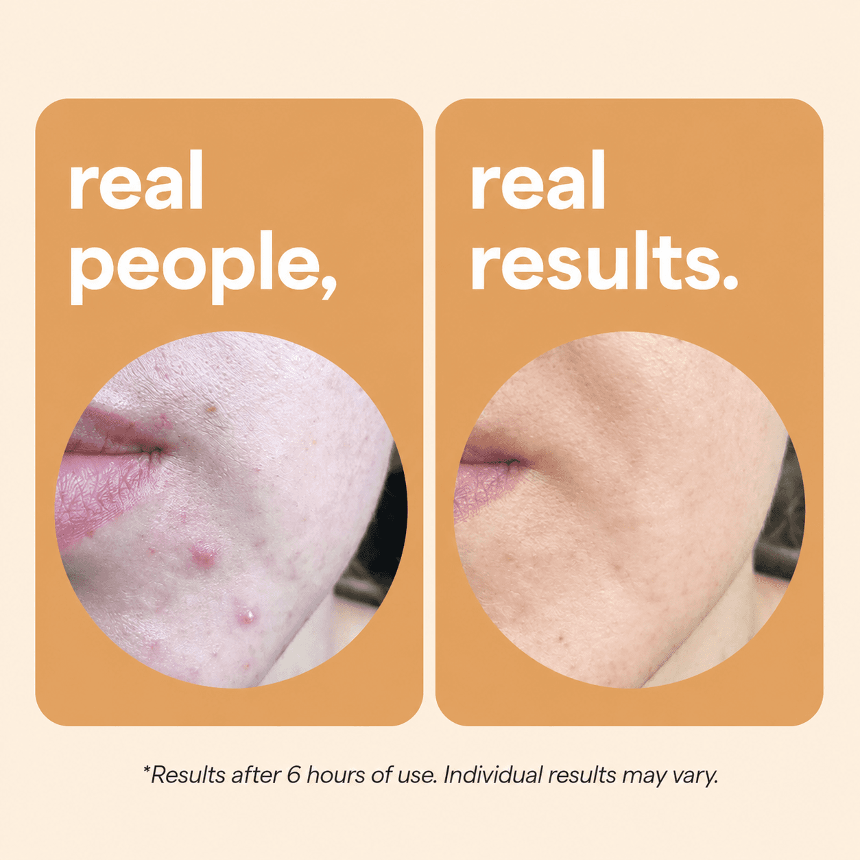 Skin Choice, Produktbilder 3